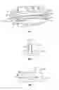 Fig. 04 - Transforaminal prosthetic spinal disc apparatus