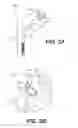 Fig. 03 - PROSTHETIC PLACEMENT TOOL AND ASSOCIATED METHODS