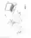 Fig. 02 - SYSTEMS AND METHODS FOR MEASURING PERFORMANCE PARAMETERS RELATED TO ORTHOPEDIC ARTHROPLASTY