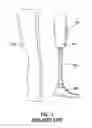 Fig. 02 - Prosthetic limb structure and fabrication method
