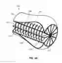 Fig. 06 - Prosthetic limb structure and fabrication method