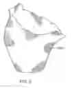 Fig. 12 - Methods for bone stabilization