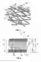 Fig. 02 - Implantable prosthesis with radiopaque particles and method of making same
