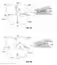 Fig. 03 - Implantable prosthesis with radiopaque particles and method of making same
