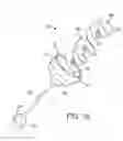 Fig. 02 - Device for intermittently obstructing a gastric opening