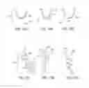 Fig. 13 - PARTIALLY ERODABLE SYSTEMS FOR TREATMENT OF OBSTRUCTIVE SLEEP APNEA