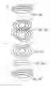 Fig. 15 - PARTIALLY ERODABLE SYSTEMS FOR TREATMENT OF OBSTRUCTIVE SLEEP APNEA