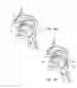 Fig. 16 - PARTIALLY ERODABLE SYSTEMS FOR TREATMENT OF OBSTRUCTIVE SLEEP APNEA