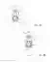 Fig. 17 - PARTIALLY ERODABLE SYSTEMS FOR TREATMENT OF OBSTRUCTIVE SLEEP APNEA