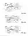 Fig. 19 - PARTIALLY ERODABLE SYSTEMS FOR TREATMENT OF OBSTRUCTIVE SLEEP APNEA