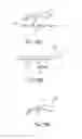Fig. 26 - PARTIALLY ERODABLE SYSTEMS FOR TREATMENT OF OBSTRUCTIVE SLEEP APNEA