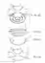 Fig. 28 - PARTIALLY ERODABLE SYSTEMS FOR TREATMENT OF OBSTRUCTIVE SLEEP APNEA