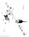 Fig. 07 - Vitrectomy surgical apparatus with cut timing based on pressures encountered