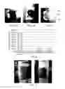 Fig. 03 - Wound dressing and method of treatment