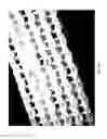 Fig. 24 - Wound dressing and method of treatment