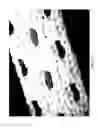 Fig. 25 - Wound dressing and method of treatment