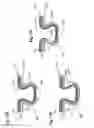 Fig. 18 - ABSORBENT ARTICLE COMPRISING A THREE-DIMENSIONAL SUBSTRATE