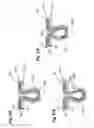 Fig. 22 - ABSORBENT ARTICLE COMPRISING A THREE-DIMENSIONAL SUBSTRATE