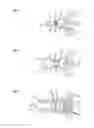 Fig. 06 - Stimulation device