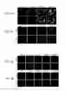 Fig. 07 - Multifunctional nanoparticle systems and methods for cancer diagnosis and combination therapy