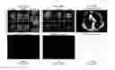 Fig. 25 - Multifunctional nanoparticle systems and methods for cancer diagnosis and combination therapy