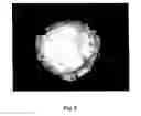 Fig. 09 - Tamper resistant dosage forms