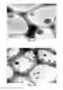 Fig. 03 - NANOPARTICLES FOR DERMAL AND SYSTEMIC DELIVERY OF DRUGS