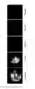 Fig. 06 - NANOPARTICLES FOR DERMAL AND SYSTEMIC DELIVERY OF DRUGS