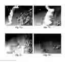 Fig. 09 - NANOPARTICLES FOR DERMAL AND SYSTEMIC DELIVERY OF DRUGS