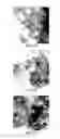 Fig. 14 - NANOPARTICLES FOR DERMAL AND SYSTEMIC DELIVERY OF DRUGS