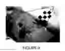 Fig. 10 - COMPOSITIONS AND METHODS FOR INTRADERMAL VACCINE DELIVERY