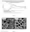 Fig. 04 - Induced expression of brain derived neurotrophic factor (BDNF) for treatment of neuromuscular, neurodegenerative, autoimmune, developmental and/or metabolic diseases