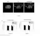 Fig. 11 - Induced expression of brain derived neurotrophic factor (BDNF) for treatment of neuromuscular, neurodegenerative, autoimmune, developmental and/or metabolic diseases