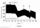 Fig. 15 - SYNTHESIS AND GROWTH REGULATORY ACTIVITY OF A PROTOTYPE MEMBER OF A NEW FAMILY OF AMINOTHIOL RADIOPROTECTORS