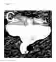 Fig. 06 - Pharmaceutical compositions comprising glitazones and NRF2 activators