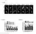 Fig. 06 - Compositions and methods to treat vision disorders