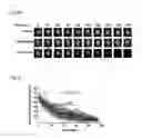 Fig. 07 - Compositions and methods to treat vision disorders