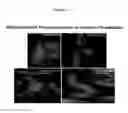 Fig. 03 - Methods and compositions for mitochondrial replacement therapy