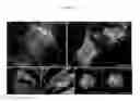 Fig. 07 - Methods and compositions for mitochondrial replacement therapy