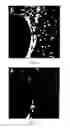 Fig. 10 - Method of stem cell delivery into the brain during chronic disease using blood brain barrier permeabilizers