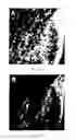 Fig. 12 - Method of stem cell delivery into the brain during chronic disease using blood brain barrier permeabilizers