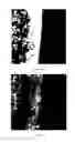 Fig. 14 - Method of stem cell delivery into the brain during chronic disease using blood brain barrier permeabilizers