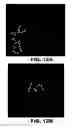 Fig. 16 - Antithrombotic nanoparticle