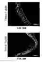 Fig. 29 - Antithrombotic nanoparticle