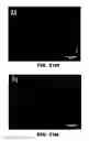 Fig. 37 - Antithrombotic nanoparticle