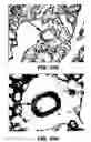 Fig. 57 - Antithrombotic nanoparticle