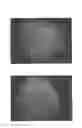 Fig. 05 - Method for treating alopecia with B-type natriuretic peptide
