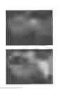 Fig. 06 - Method for treating alopecia with B-type natriuretic peptide