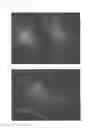 Fig. 08 - Method for treating alopecia with B-type natriuretic peptide