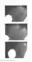Fig. 09 - Method for treating alopecia with B-type natriuretic peptide